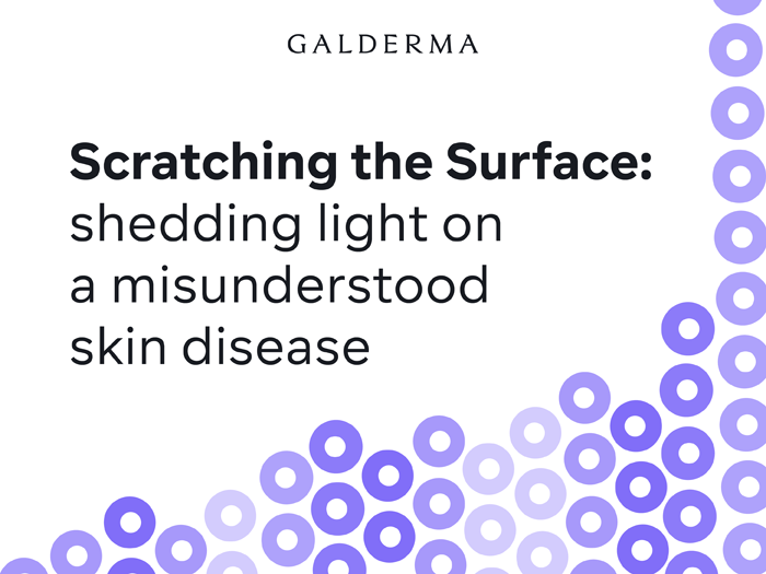 Scatching the Surface - PN article