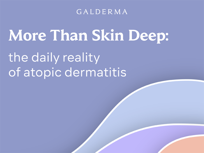 The daily reality of atopic dermatitis