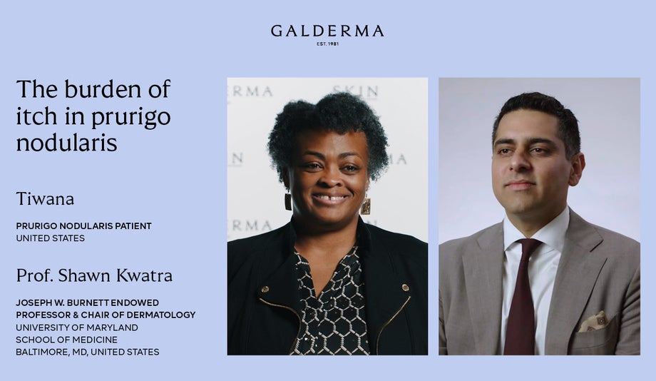 The burden of itch in prurigo nodularis