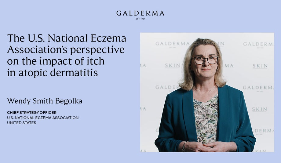 The U.S. National Eczema Association’s perspective on the impact of itch in atopic dermatitis 